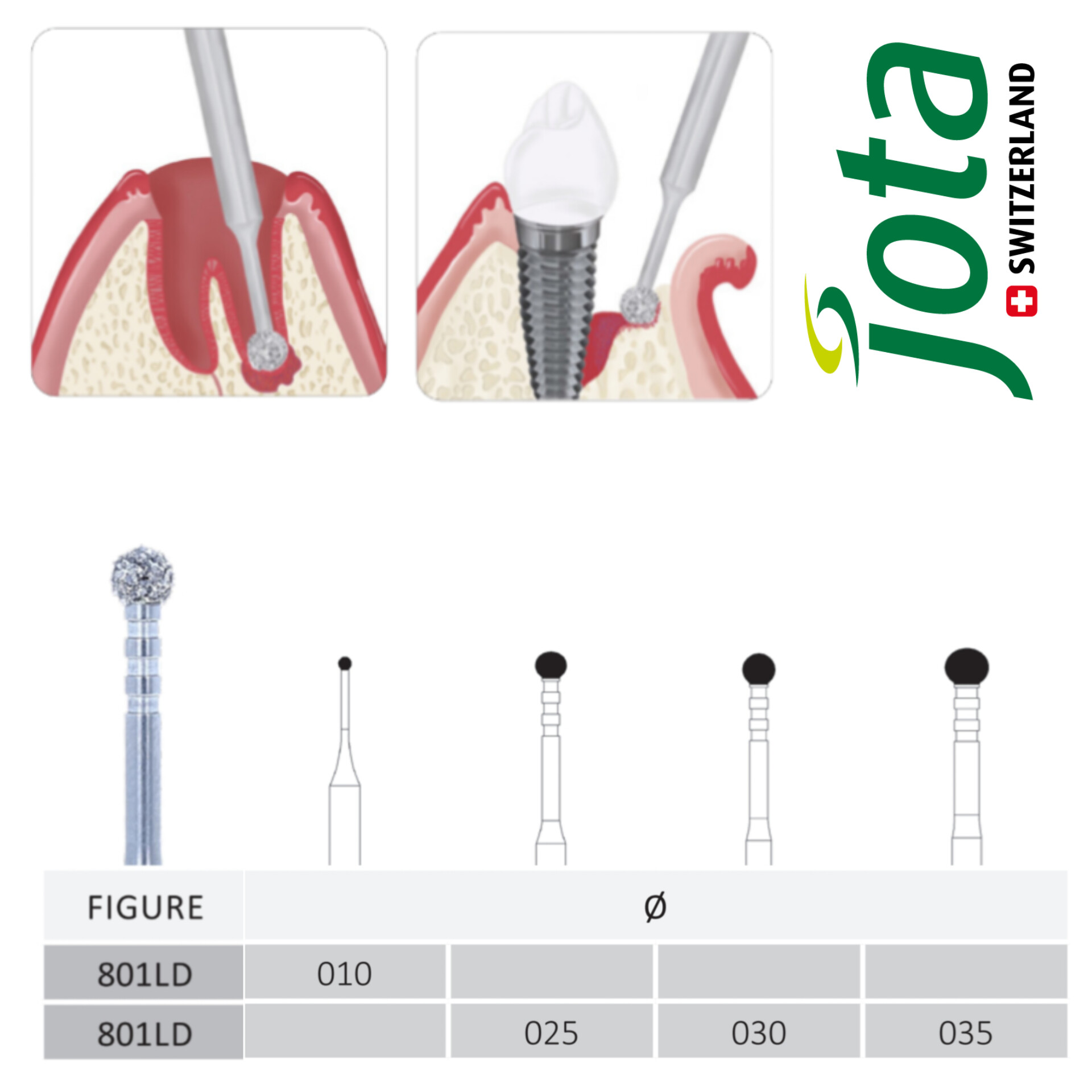 فرز الماسی جراحی گرانولاسیون مخصوص آنگل جوتا JOTA کد 801LD