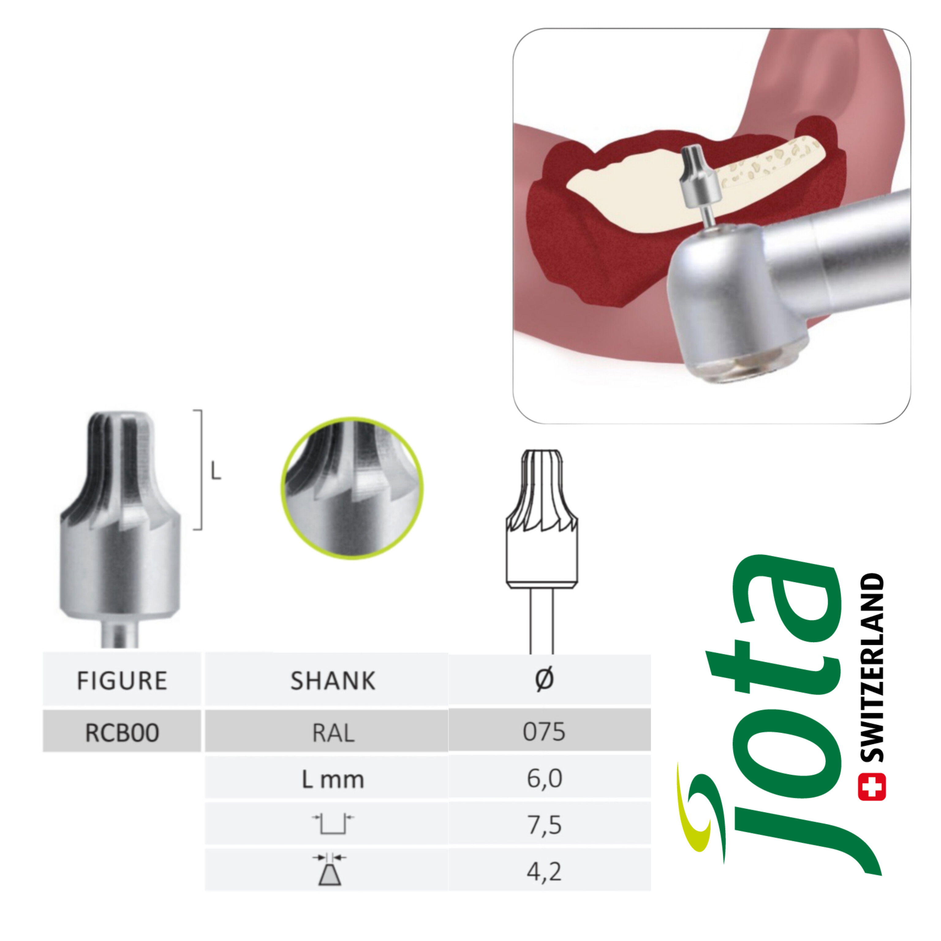 فرز جراحی کارباید آلو‌ئوپلاستی برای کانتورینگ ریج جوتا JOTA کد RCB00